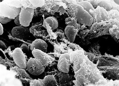 โรคกาฬโรค (Plague)